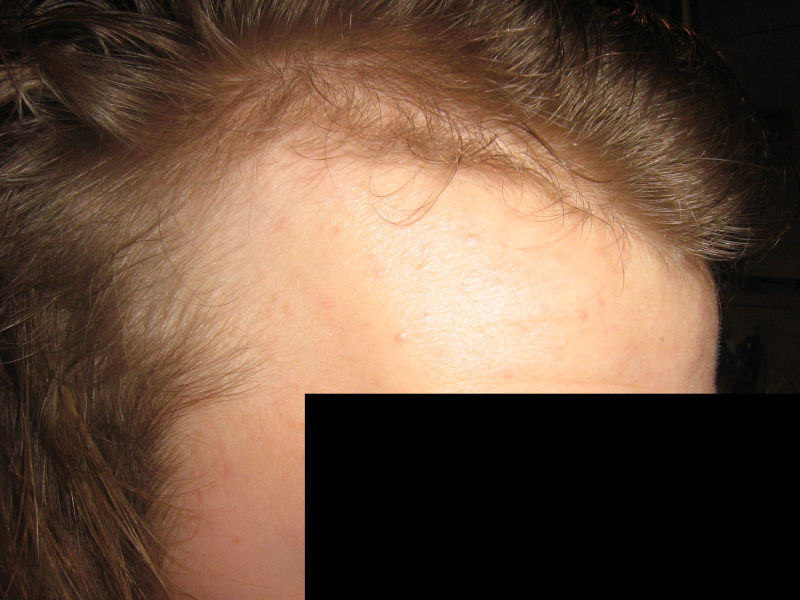 index.php/fa/4542/0/