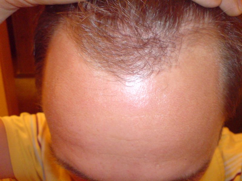 index.php/fa/4596/0/