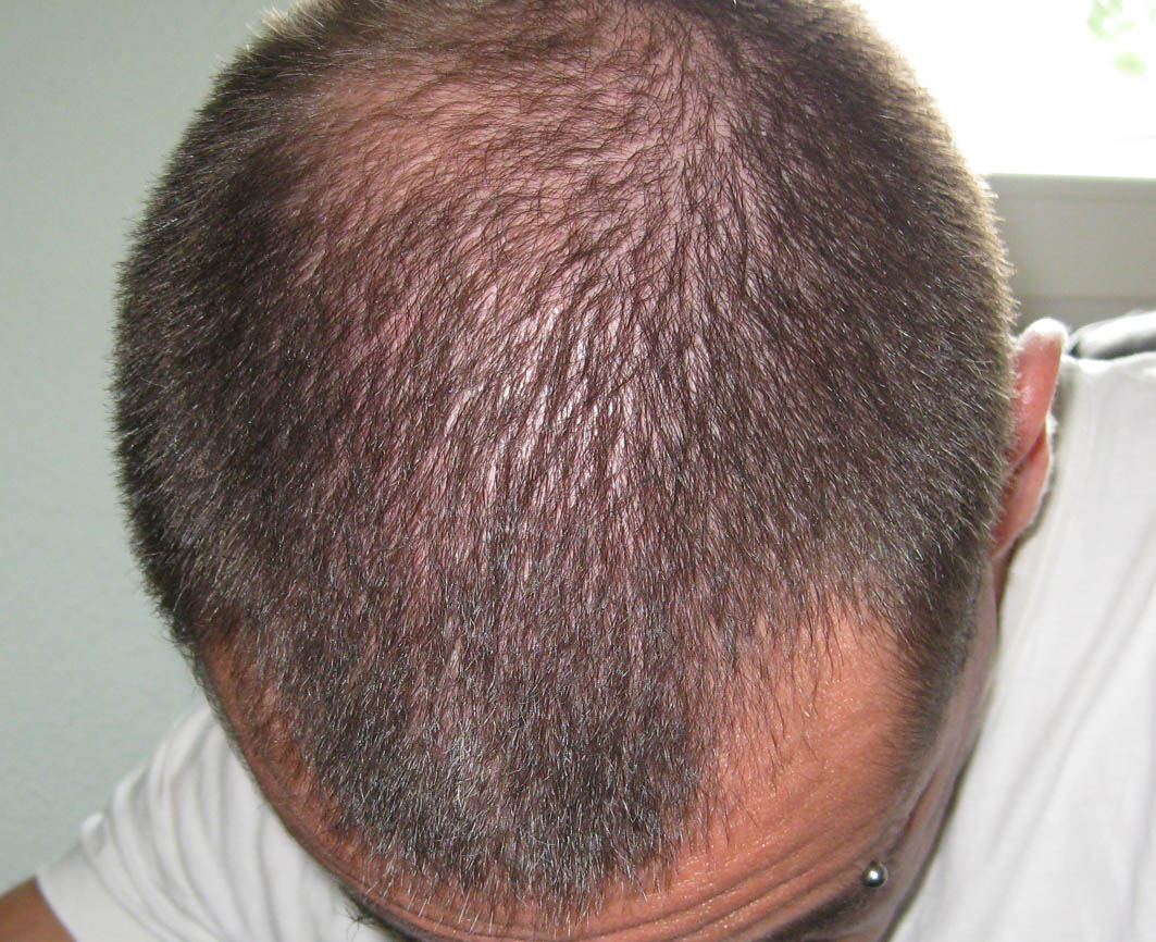 index.php/fa/4599/0/