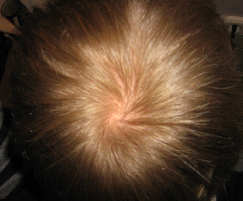 index.php/fa/4639/0/