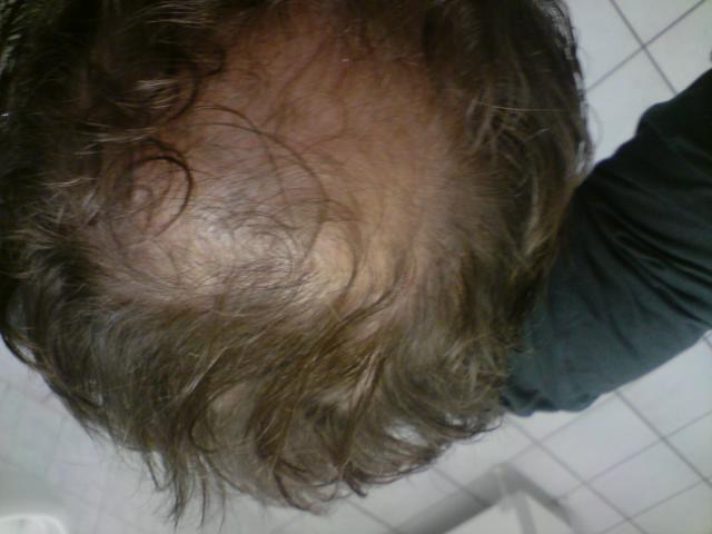 index.php/fa/4934/0/