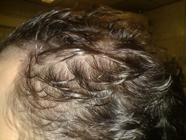 index.php/fa/4935/0/