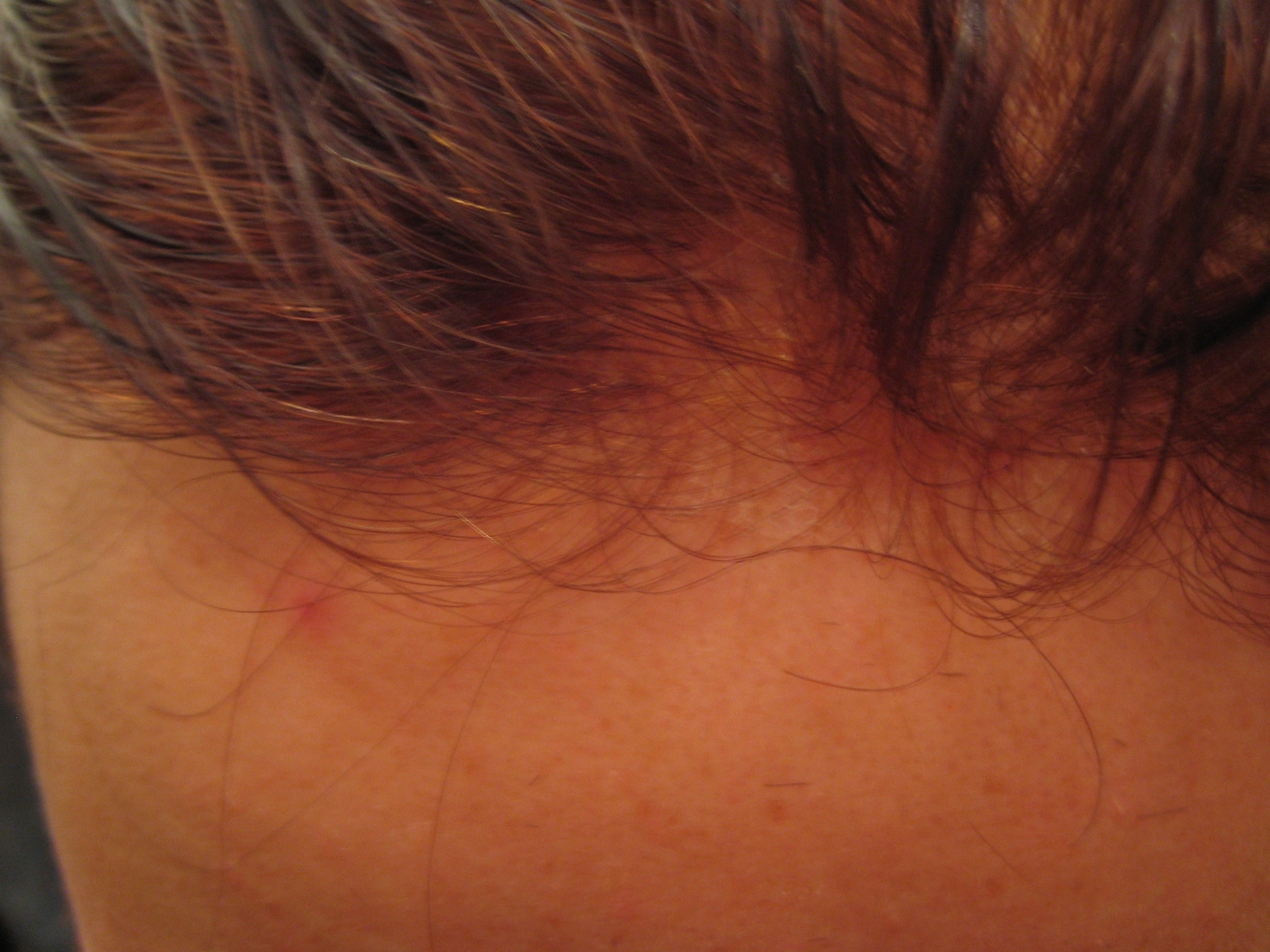 index.php/fa/4974/0/