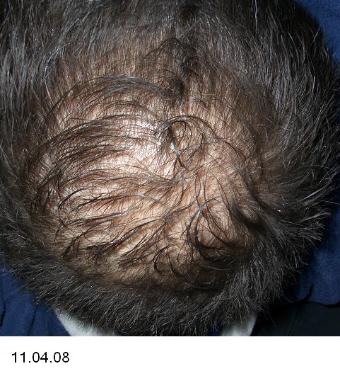 index.php/fa/5067/0/