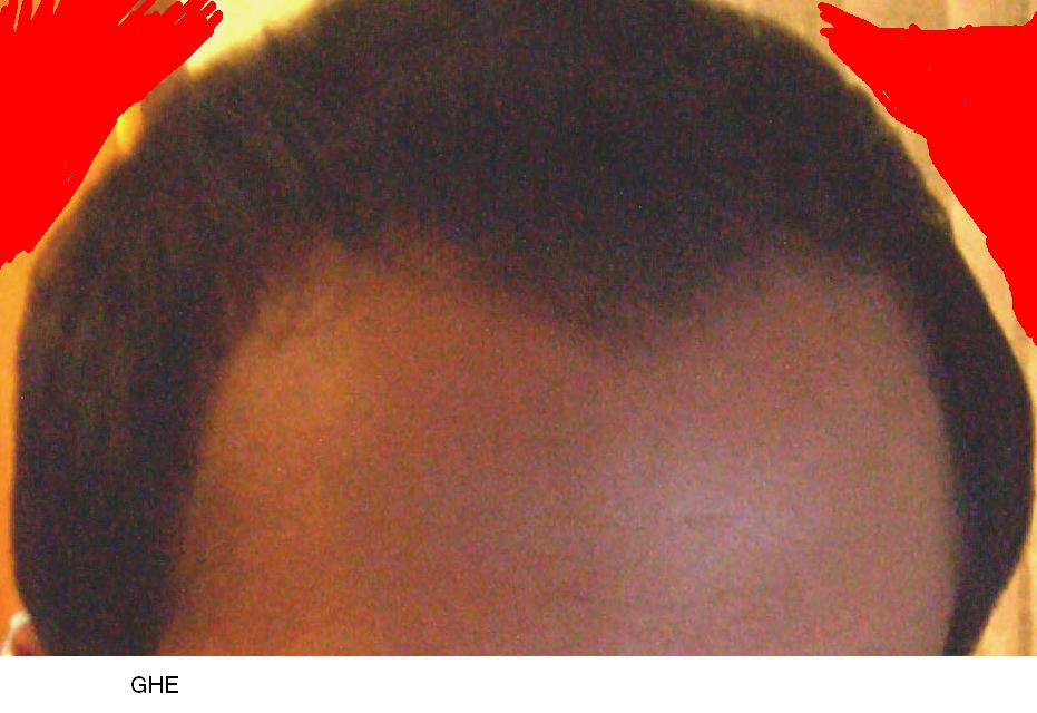 index.php/fa/5071/0/