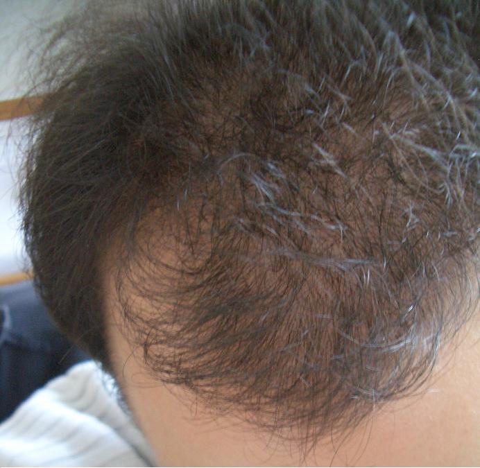 index.php/fa/5107/0/