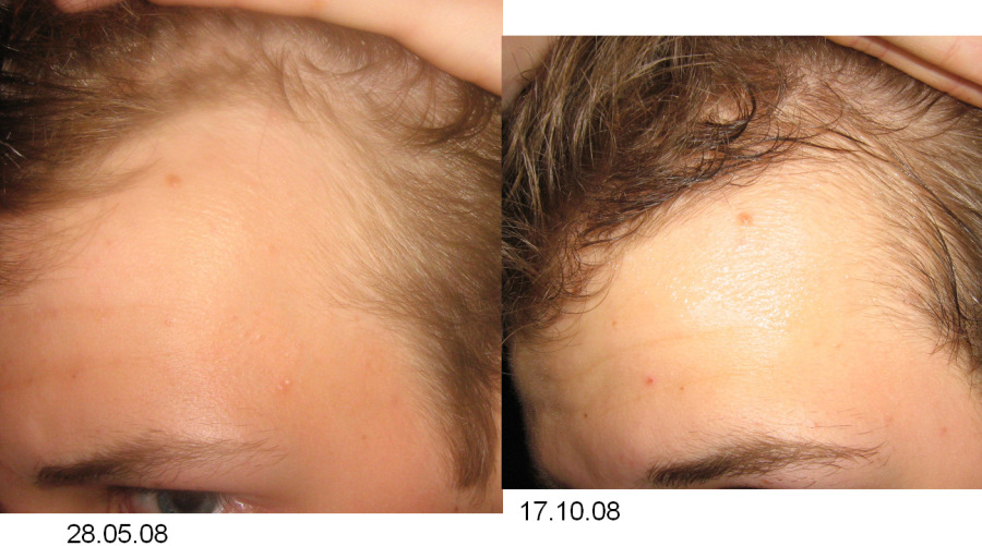 index.php/fa/5200/0/