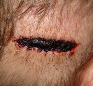 index.php/fa/5247/0/