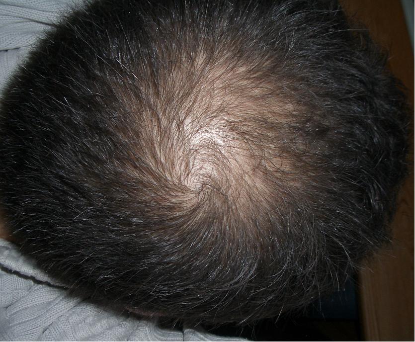 index.php/fa/5248/0/