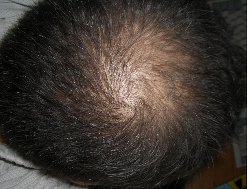 index.php/fa/5249/0/