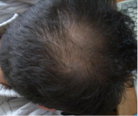 index.php/fa/5292/0/