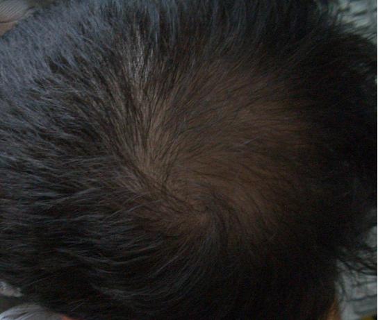 index.php/fa/5295/0/