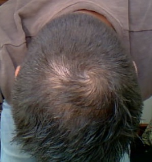 index.php/fa/5306/0/