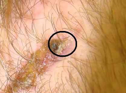 index.php/fa/5319/0/