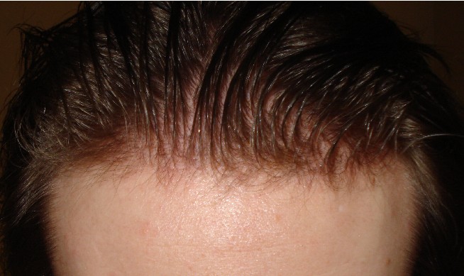 index.php/fa/5446/0/