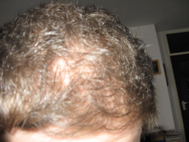 index.php/fa/5511/0/