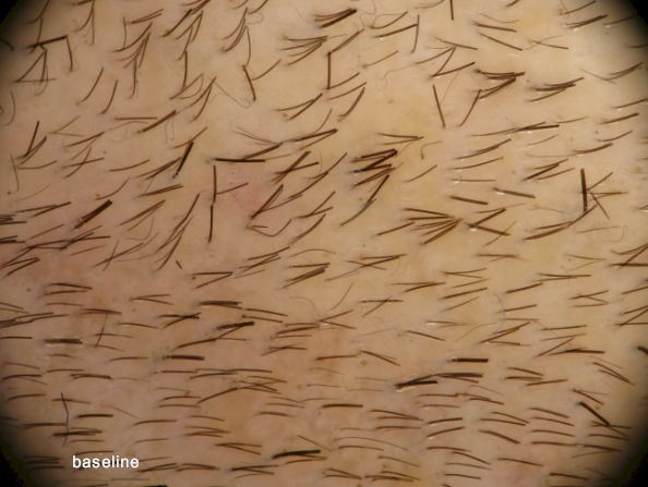 index.php/fa/5600/0/