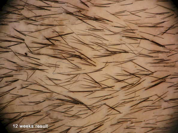 index.php/fa/5601/0/