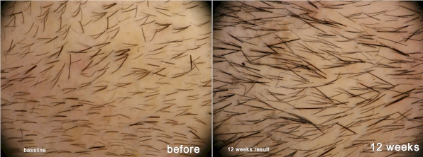 index.php/fa/5602/0/