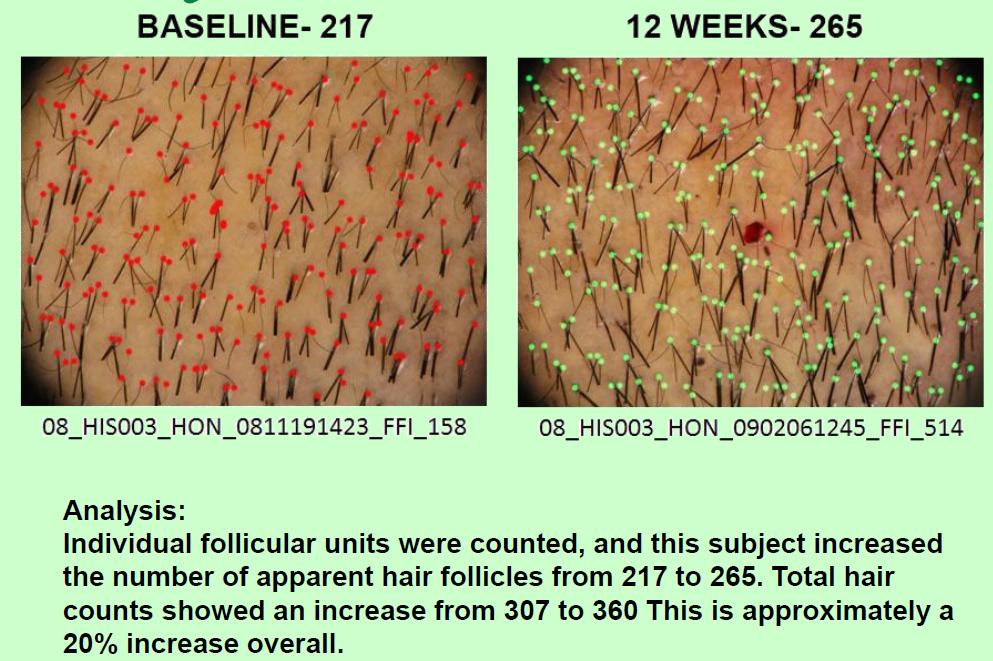 index.php/fa/5615/0/
