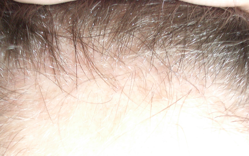 index.php/fa/5631/0/