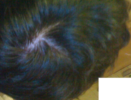 index.php/fa/5665/0/