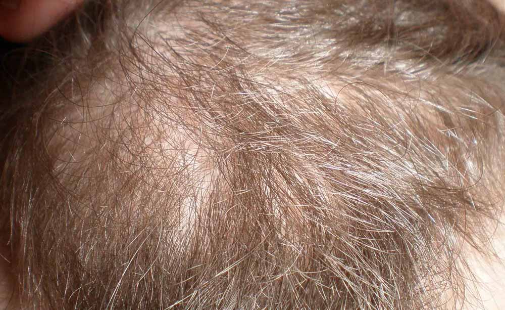 index.php/fa/5780/0/