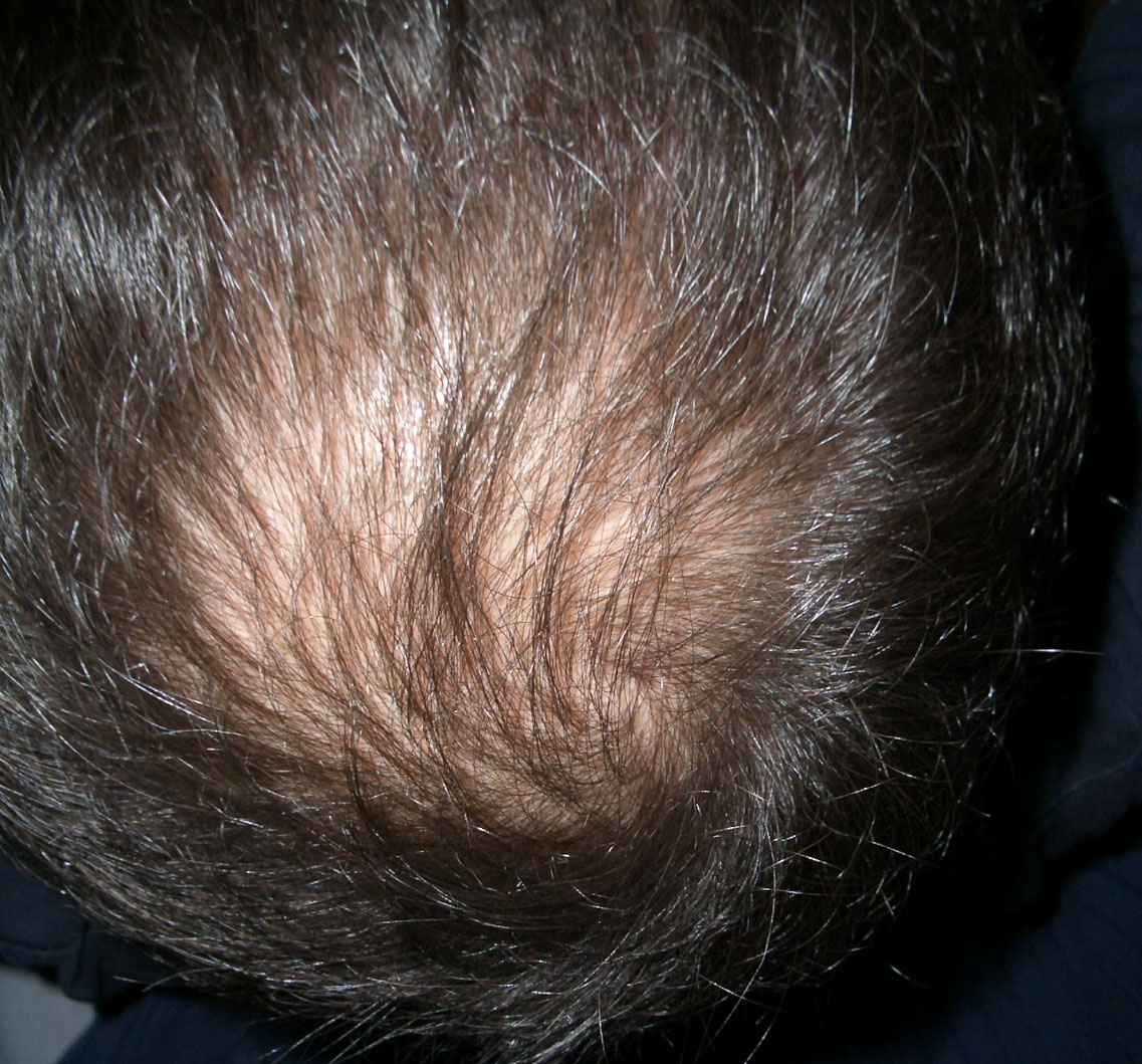 index.php/fa/5857/0/