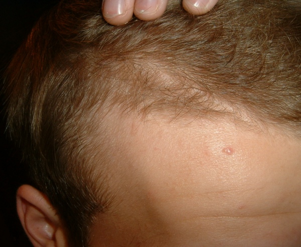 index.php/fa/5979/0/