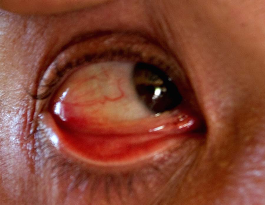 index.php/fa/6144/0/