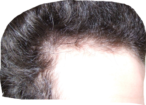 index.php/fa/6294/0/