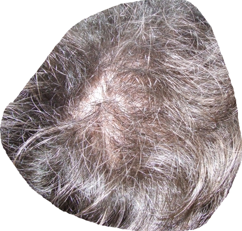 index.php/fa/6295/0/