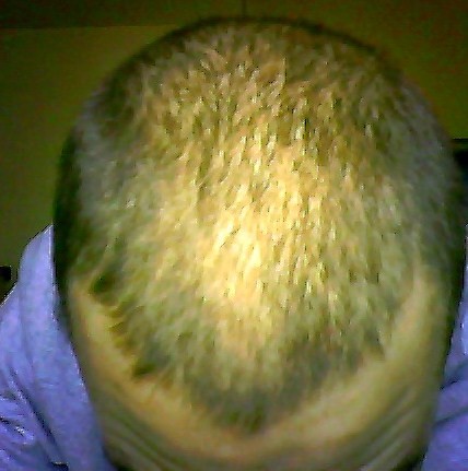 index.php/fa/6451/0/