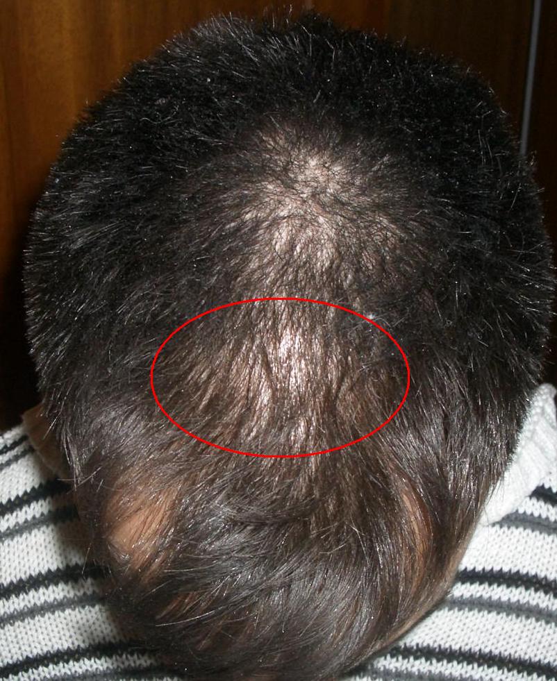 index.php/fa/6699/0/