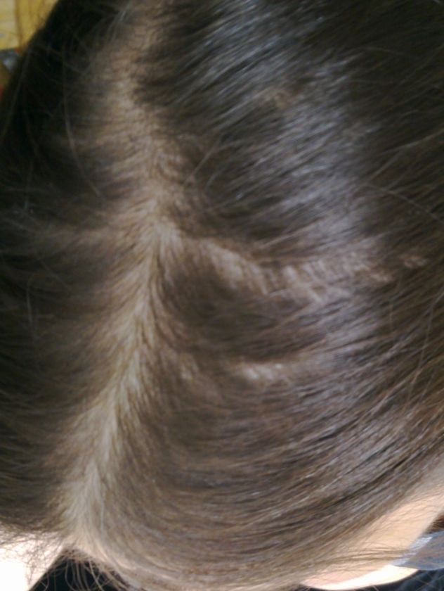 Haarausfall Allgemeines Forum Haare Und Haarausfall Wieviel Haare Fallen So Runter