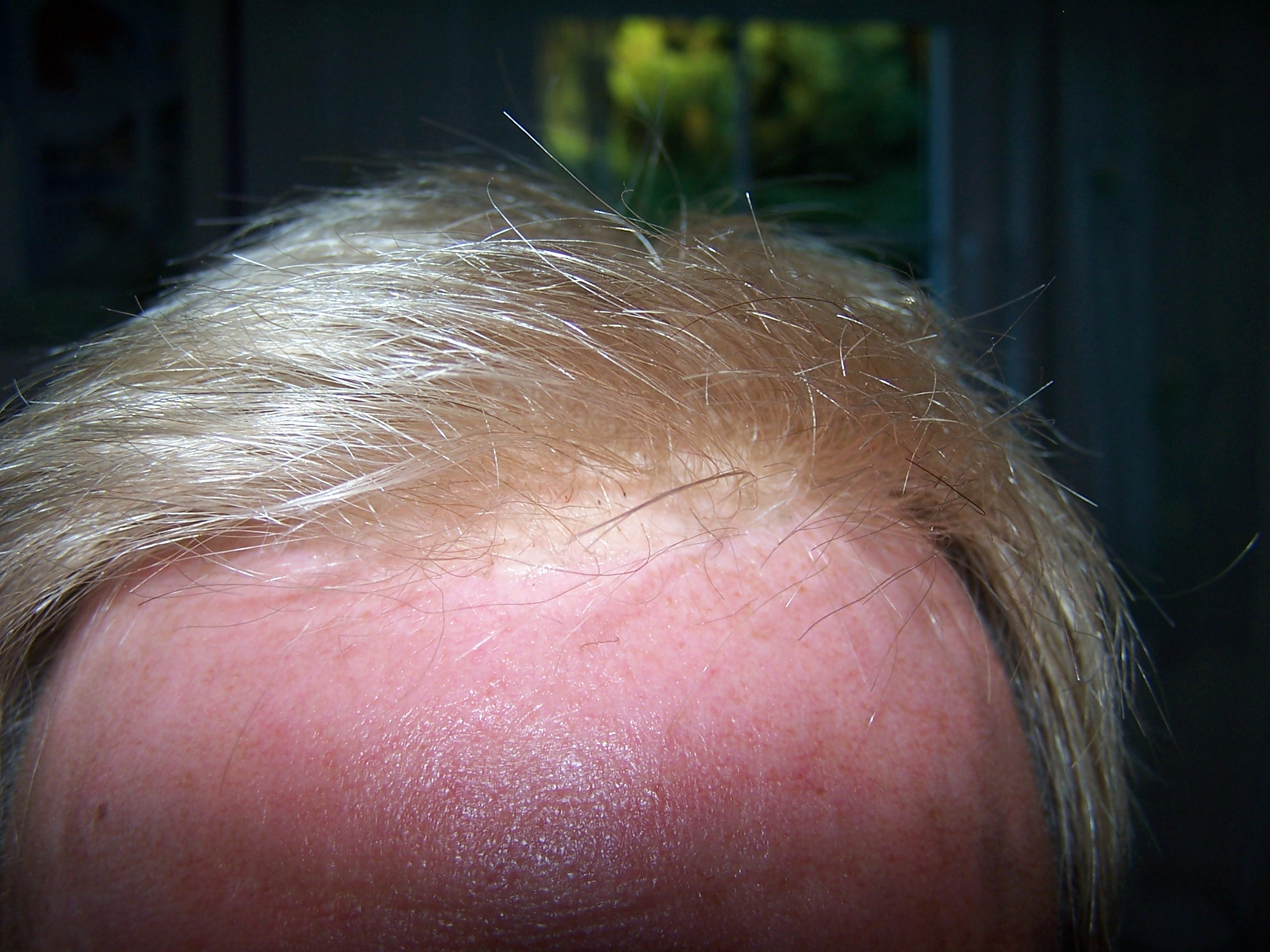 index.php/fa/6923/0/