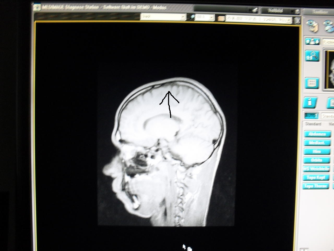 index.php/fa/7025/0/