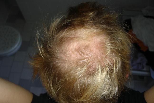 index.php/fa/7185/0/