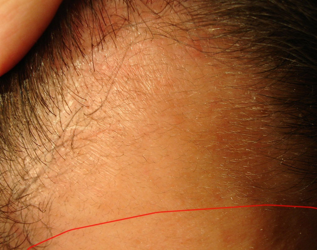 index.php/fa/7987/0/