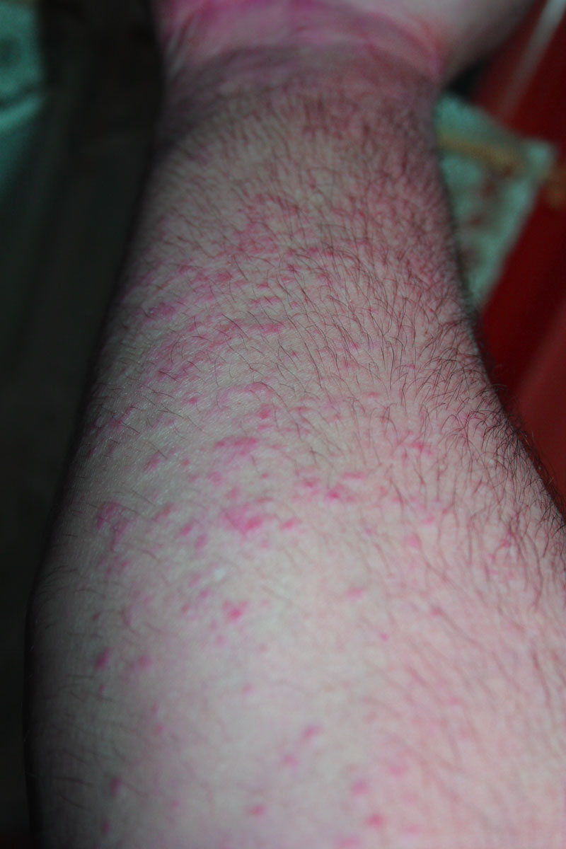 index.php/fa/8373/0/