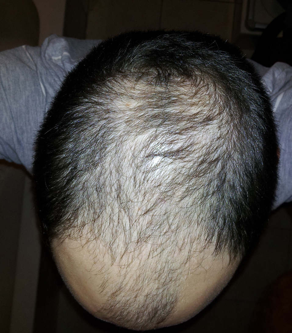 index.php/fa/9087/0/