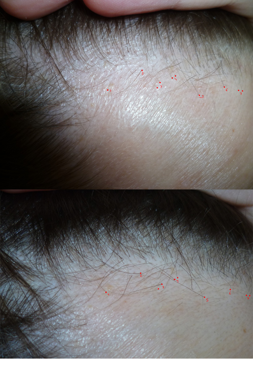 index.php/fa/9125/0/