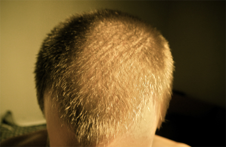 index.php/fa/9133/0/