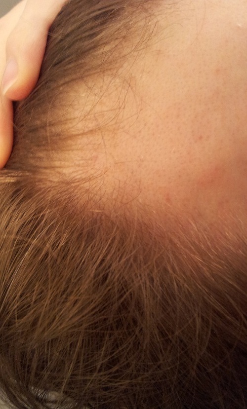 index.php/fa/9277/0/