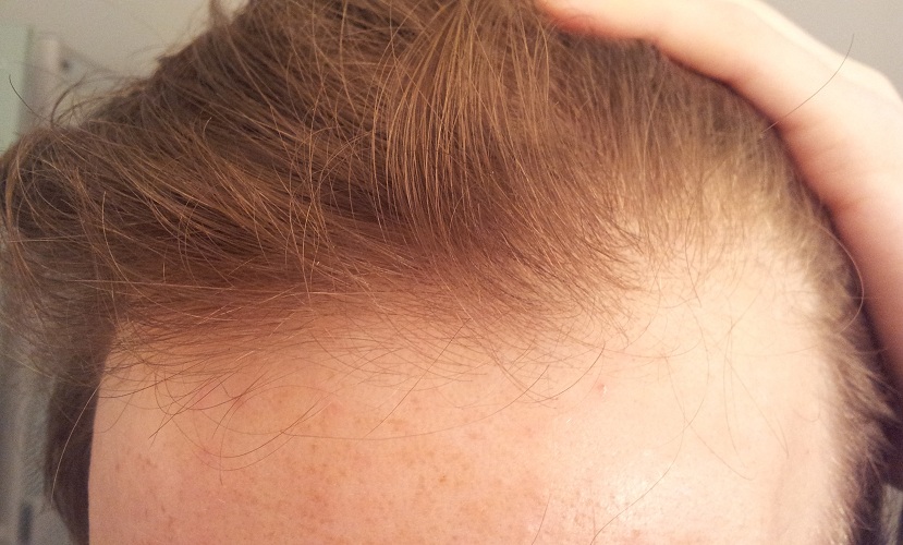 index.php/fa/9278/0/