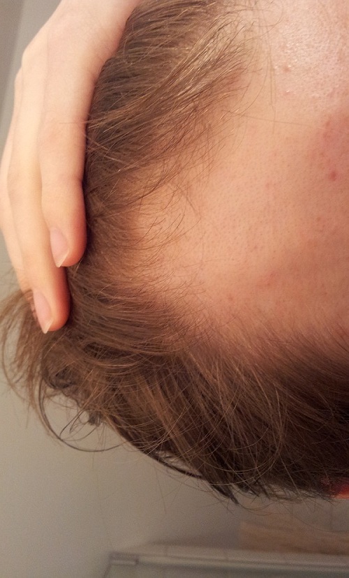 index.php/fa/9279/0/