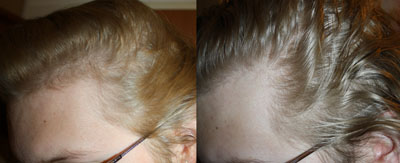 index.php/fa/9399/0/