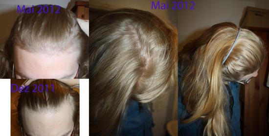 index.php/fa/9400/0/