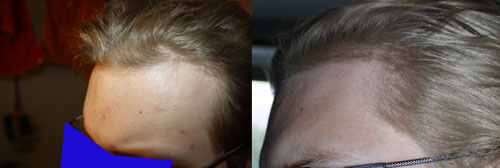 index.php/fa/9510/0/