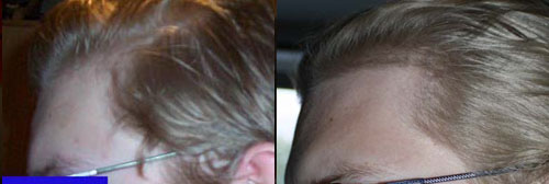 index.php/fa/9511/0/